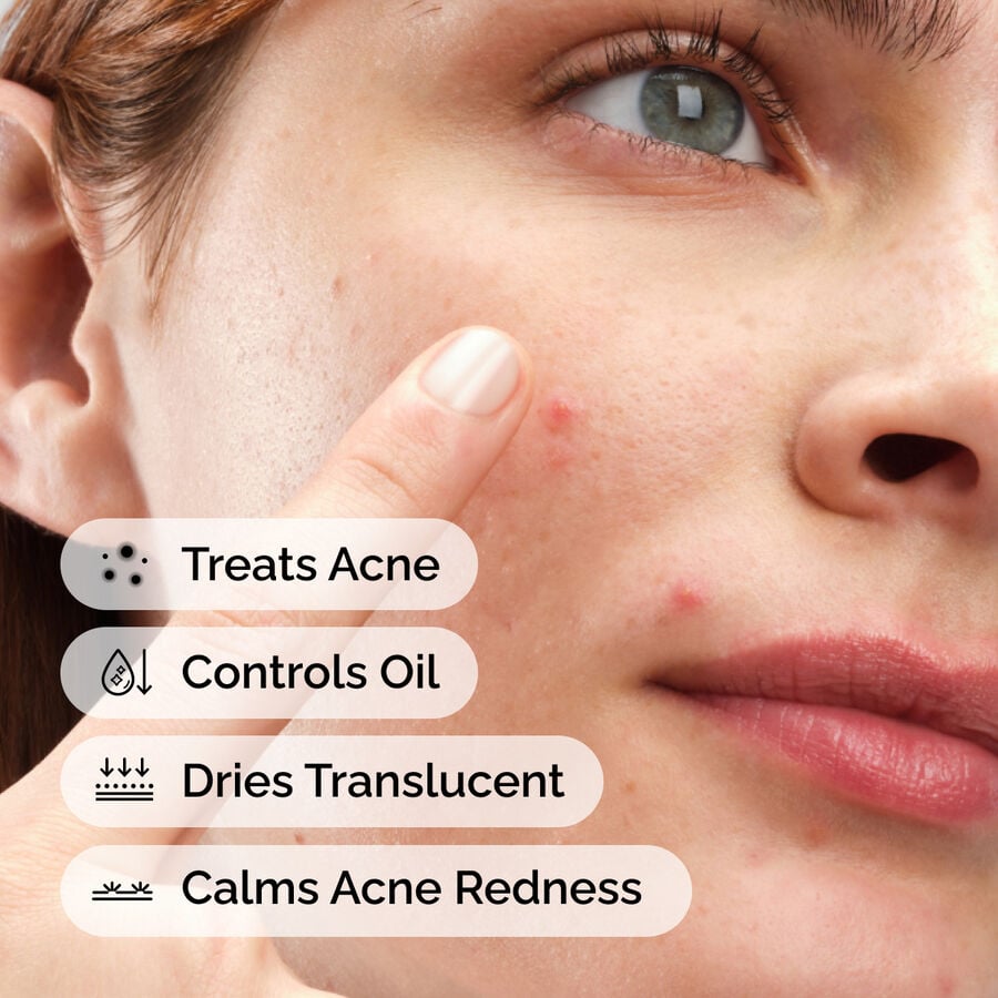 Sulfur 10% Powder-to-Cream Concentrate, a powerful acne treatment that controls oil, dries translucent for discreet wear, and calms acne redness for clearer, healthier skin.